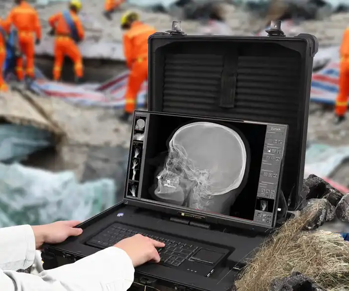 Leonardo DR mini III - tragbare Röntgensystem für Katastropheneinsätze