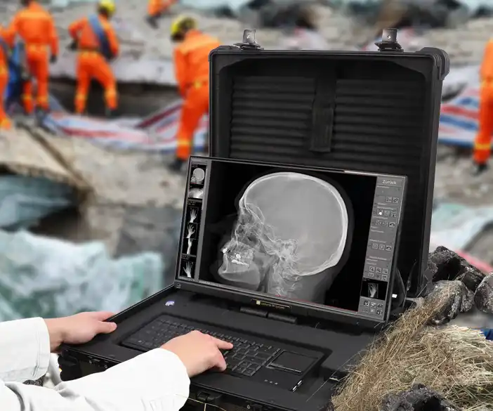 Leonardo DR mini III - portable X-ray system for disaster relief operations