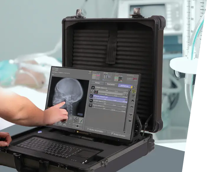 Leonardo DR mini III - flexible and lightweight X-ray system