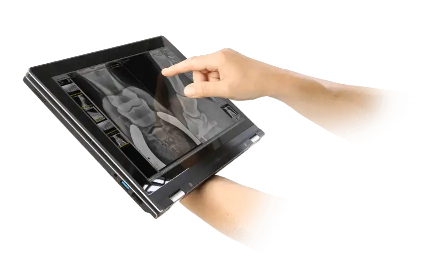 Tablette de radiographie avec logiciel de radiographie pour les vétérinaires