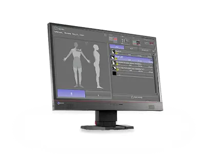 Acquisition and diagnostic software for X-ray images 