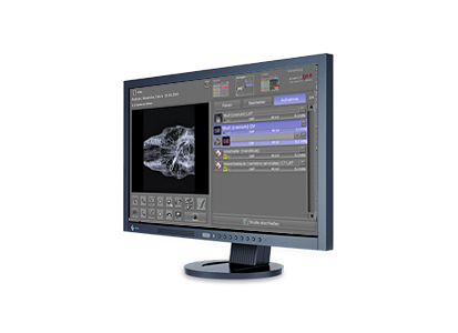 Digital X-ray: Acquisition and diagnostic software for X-ray images 