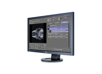 acquisition and diagnostic software with the integrated X-ray positioning guide