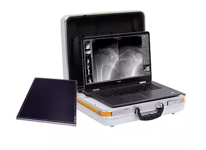 Wireless radiography with the digital system Leonardo DR mini II for mobile use