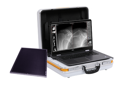 Leonardo DR mini: Portable digital X-ray system in a custom-made suitcase