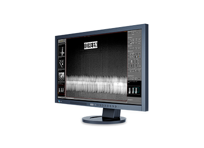 ORinspect: Professional acquisition and control software for radiographic testing (RT)