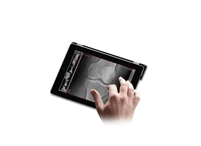 Digital X-ray: web-based viewer for mobile devices