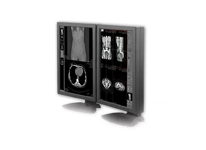 PACS radiology software - Administration and diagnosis of image slices