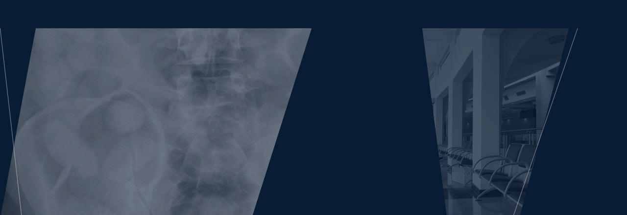 images/Produkte/Amadeo/M-mini/Security/Slider-X-ray-on-suspicion-of-bodypacking-Amadeo-M-mini-security-1.jpg