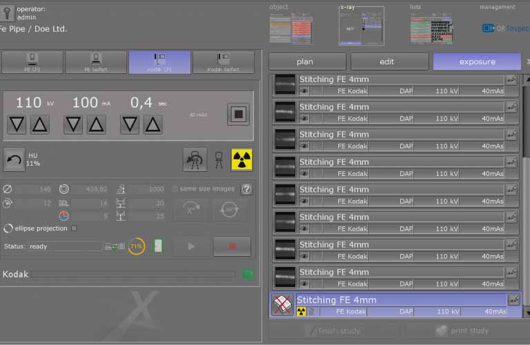 OR inspect: Professional acquisition and control software for radiographic testing (RT)