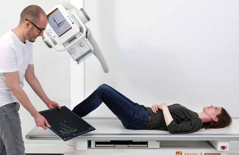 X-ray system with fast image display and exceptional image quality