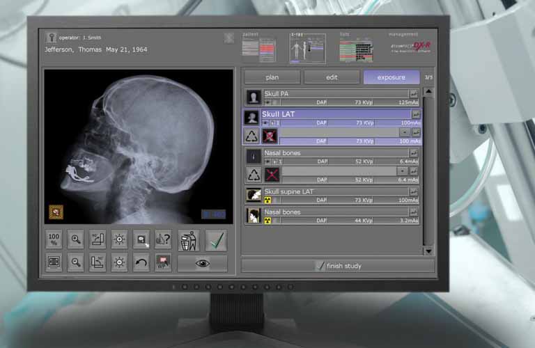 dicomPACS-DX-R-Akquisitions-Befundsoftware-Roentgenbilder-human-1