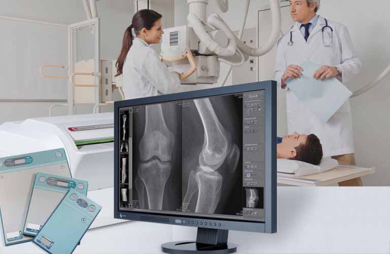 Digital X-ray: The image processing, which can be adapted to user requirements, impresses with outstanding image quality