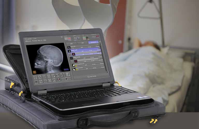 Acquisition software for X-ray images for portable X-ray solution and stationary X-ray machine