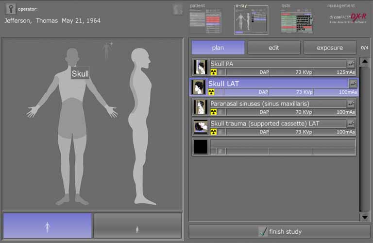 Akquisitions-Befundsoftware-Roentgenbilder-human-1-EN