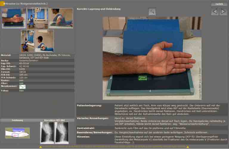 Integrierter, multimedialer Röntgenhelfer zur richtigen Einstelltechnik für jede Untersuchung inkl. vieler Hinweise, Fotos, Videos, Röntgenbilder