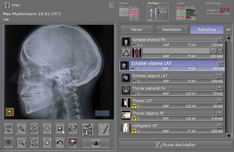 Vorschau der Röntgenaufnahme und Arbeitsliste der Akquisitions- und Befundsoftware für Röntgenbilder