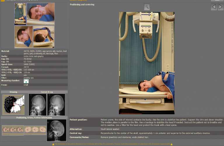 Integrated radiographic positioning guide for each examination incl. comprehensive notes, photos, videos and correct X-ray images