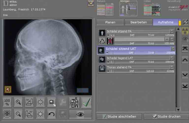 Vorschau der Röntgenaufnahme und Arbeitsliste der Akquisitions- und Befundsoftware für Röntgenbilder