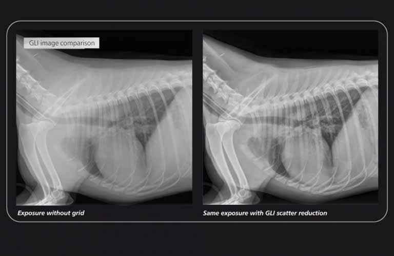 GLI (gridless imaging) – reduction of scattered radiation: professional dicomPACS DX-R  image processing