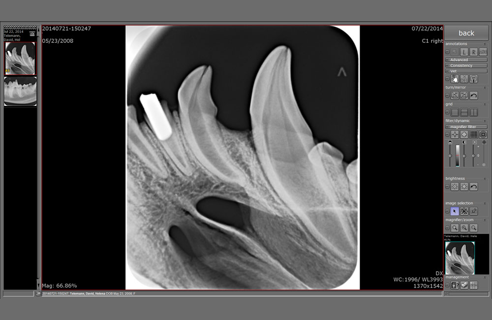Dental Imaging Software Xdr Radiology