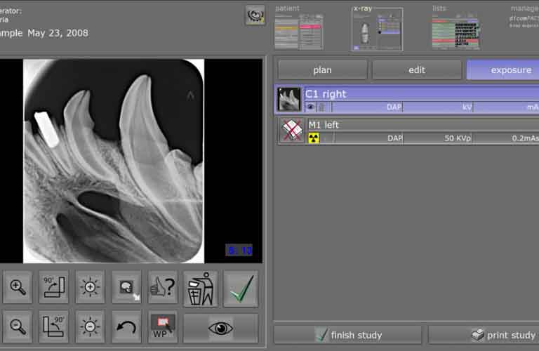 High-performance image processing allows image-specific optimisation and guarantees high-quality X-rays.