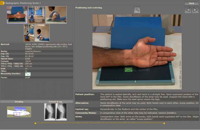 Integrated radiographic positioning guide for each examination incl. comprehensive notes, photos, videos and correct X-ray images