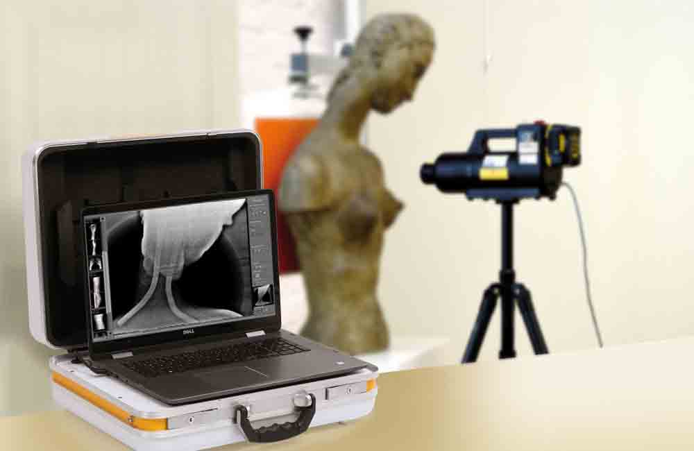 Professional X-ray software: Acquisition and diagnostic software for static and dynamic X-ray images