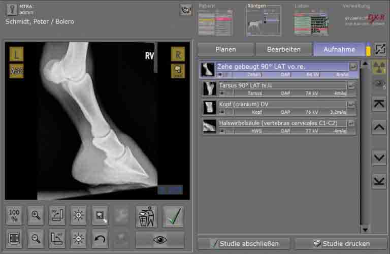 Preview image of the X-ray image (incl. various display options) [left] and work list [right]