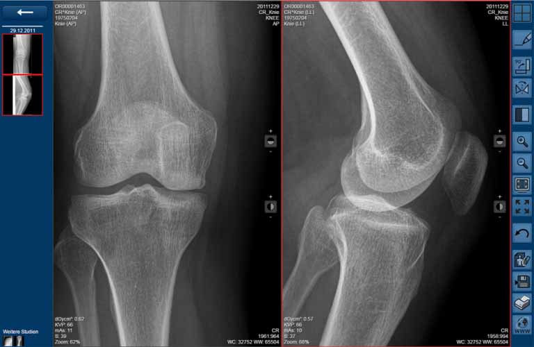 Nube DICOM ORCA Captura de pantalla - Telemedicina y archivo de imágenes, documentos y hallazgos médicos