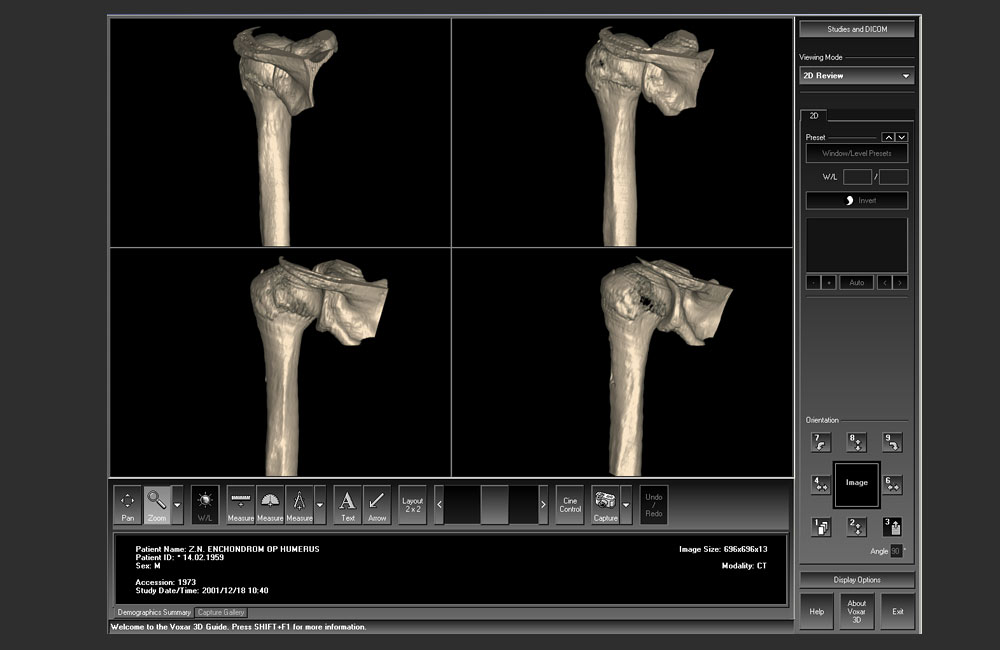 Voxar 3d Workstation