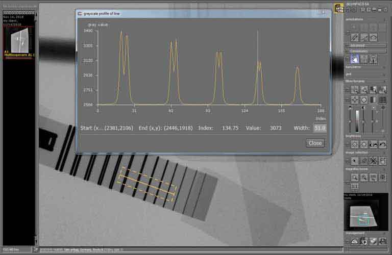 dicondePACS image management system, flexible DICONDE image archive and integrated viewing software