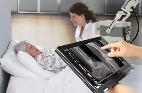 Pacs Software for mobile radiology