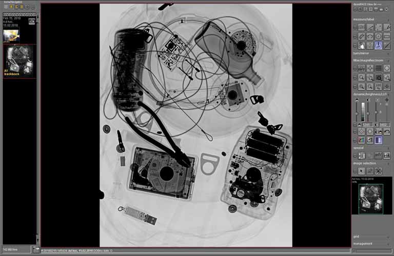 dicosPACS DICOS/DICOM viewing software with helpful filters (e. g. sharpening, inverse display, LUT, frequency filter and much more)