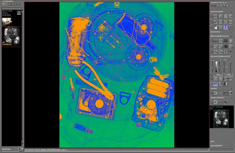 dicosPACS DICOS/DICOM viewing software with numerous special filters (e. g. pseudo / false color presentation)