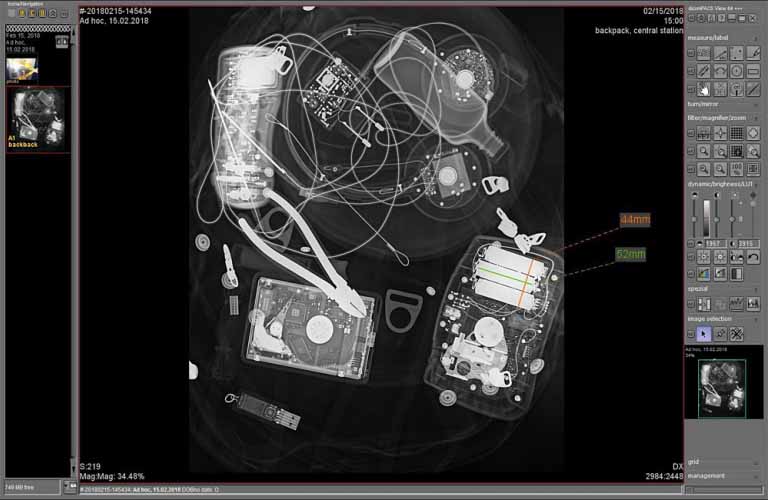 dicosPACS DICOS/DICOM viewing software with measuring tools to analyze your images and intuitive image labeling tools.
