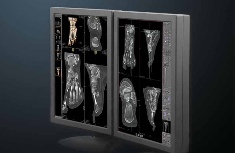 medical PACS software for radiology and hospital 