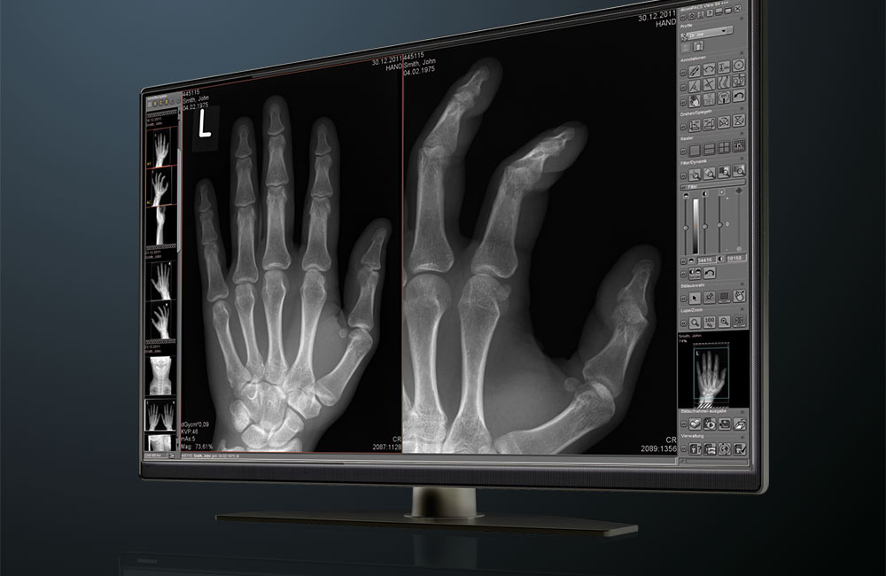 Solutions For Digital X Ray Imaging