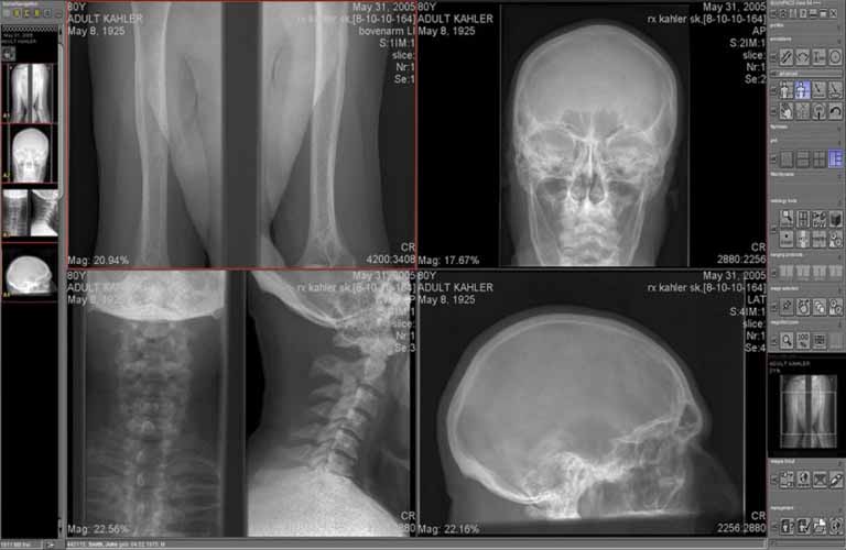 Medical PACS software: processing, administration and archiving of diagnostic X ray images