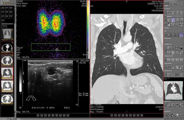 dicom PACS Software includes professional tools, such as MPR and MIP, to evaluate cross sectional images