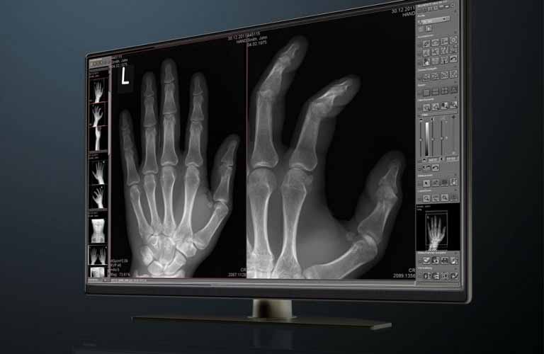 Digital X ray with dicomPACS Software