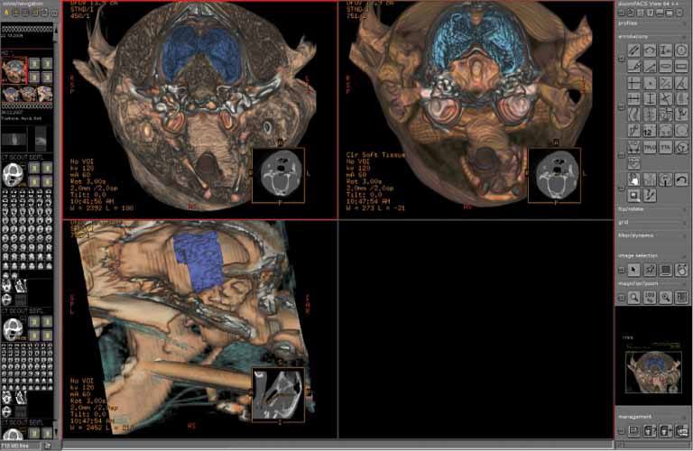 dicomPACS®vet  includes all the necessary tools for the professional  diagnostic evaluation of slices, such as CT or MRI