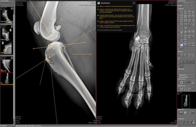 MMP (Modified Maquet Procedure)