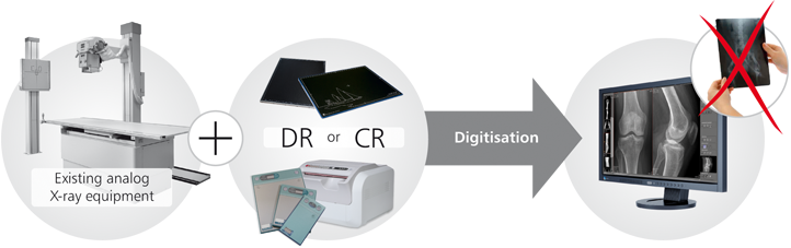 Digital radiography High resolution digital X ray images and reduced radiation exposure