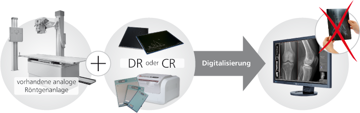 Digitales Röntgen / digitale Röntgentechnik versus herkömmliches Röntgen