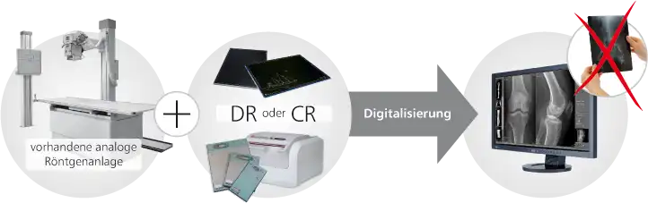 Digitales Röntgen / digitale Röntgentechnik versus herkömmliches Röntgen