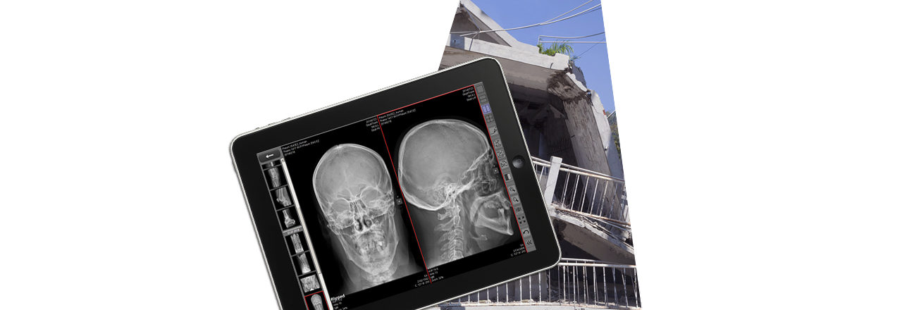 Pacs Web Based Viewer For Mobile Services Emergencies