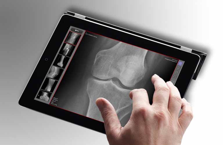  PACS - Extension module of the diagnostic software: Web diagnosis of X-ray images