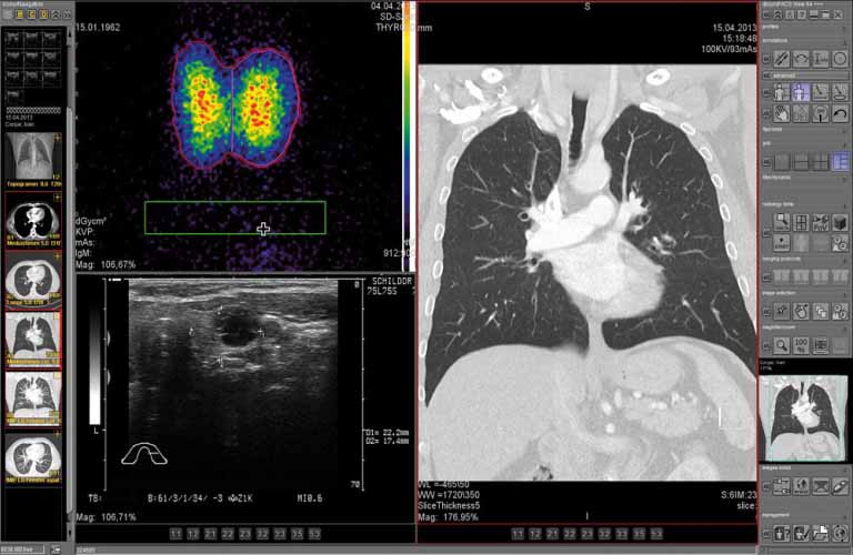 PACS: necessary tools for professional diagnosis of sectional images