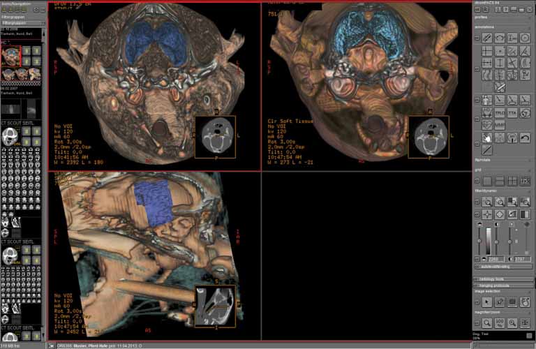 Administration-and-diagnostic-evaluation-of-image-slices-5EN